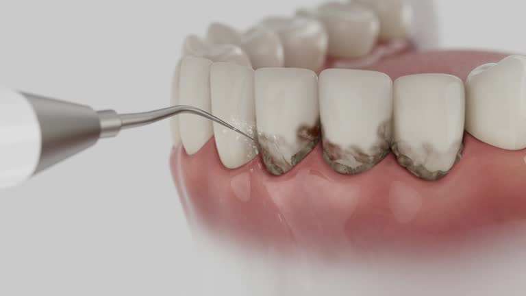 Reliable Dental Implants contractor in Rosedale, LA by Smile Center Dentistry